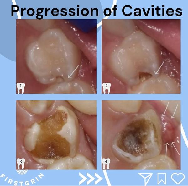 Post by pediatric.dentist.mom