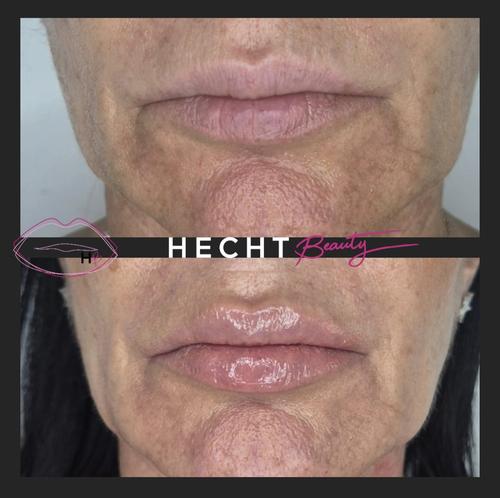 Post by hecht_beauty