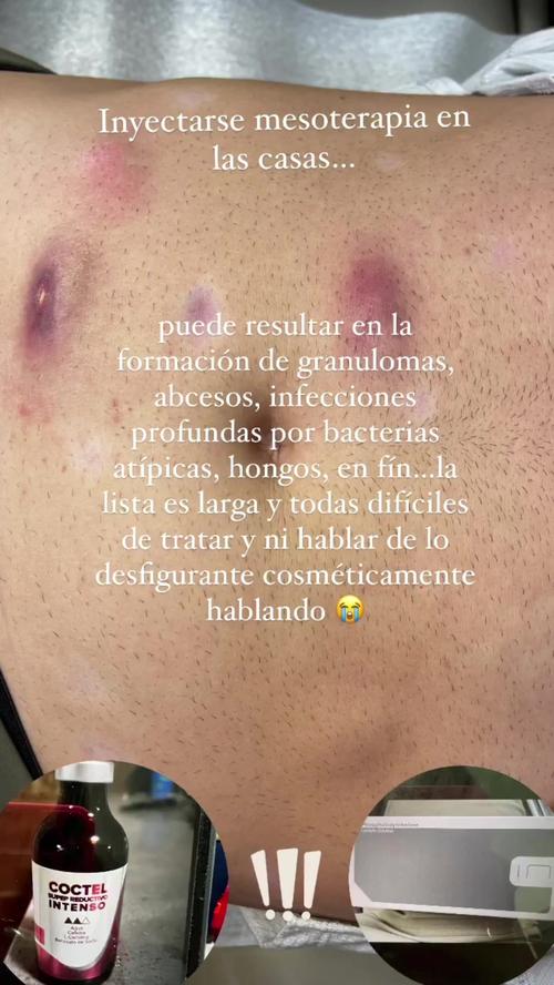 Post by dianavalentinmd