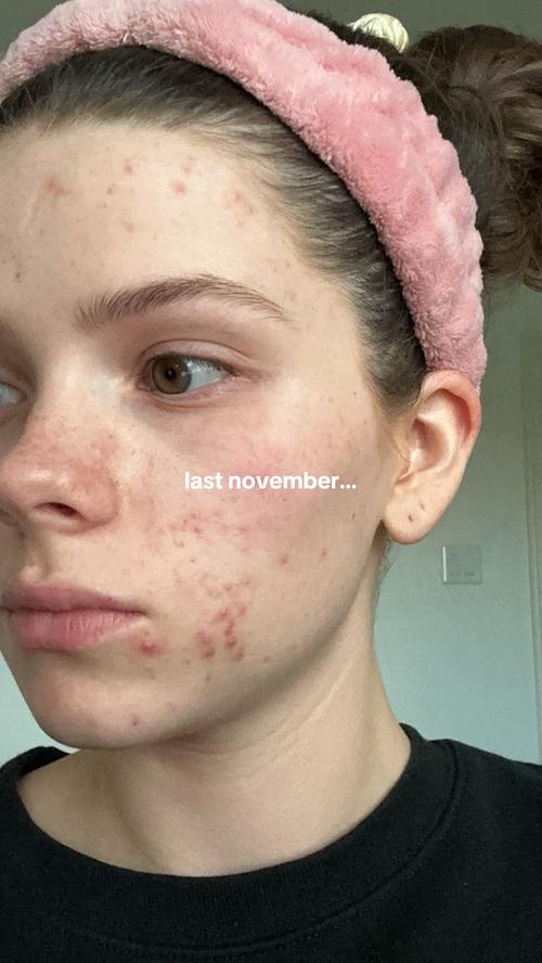 Post by maddisonlainedawson