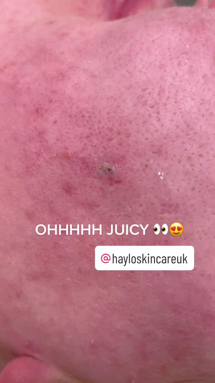 Post by hayloskincareuk