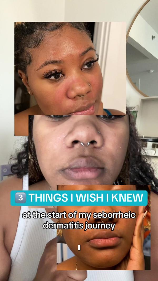 Post by myskinfrastructure