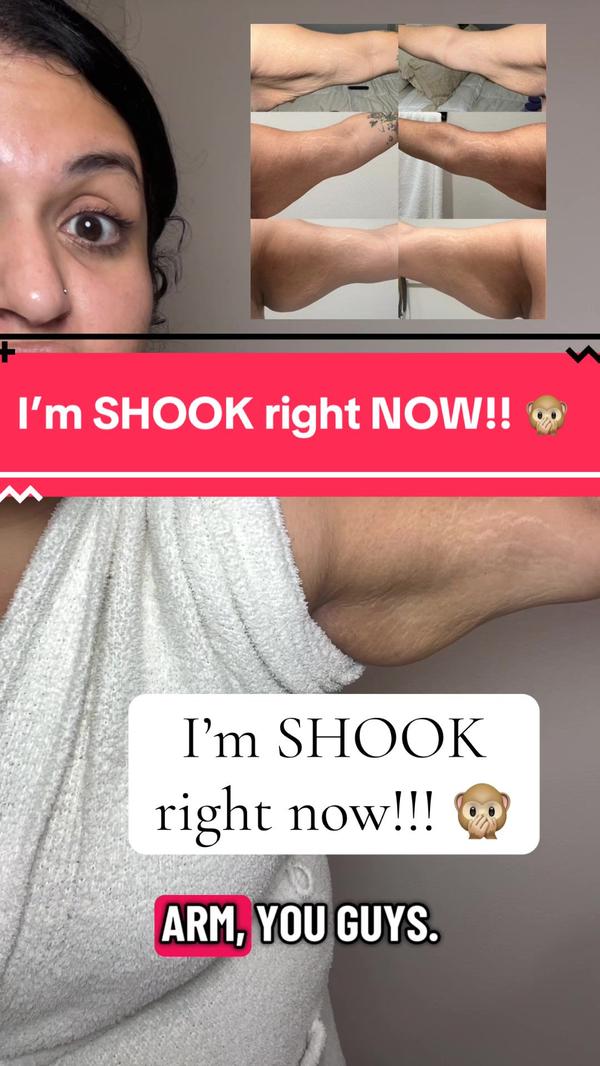 Post by lanena.skin.health